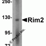 Western blot analysis of Rim2 in rat brain tissue lysate with Rim2 antibody at 1 μg/mL in the (A) absence or (B) presence of blocking peptide.