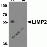 Western blot analysis of LIMP2 in human skeletal muscle tissue lysate with LIMP2 antibody at 1 μg/mL in (A) the absence and (B) presence of blocking peptide.