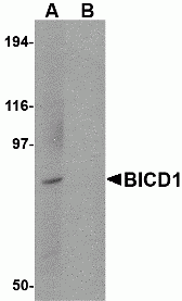 BICD1 Peptide