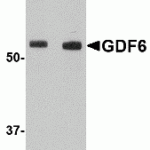 Western blot analysis of Nanos1 in SK-N-SH cell lysate with Nanos1 antibody at 1 μg/mL in (A) the presence and (B) the absence of blocking peptide.