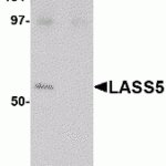 Western blot analysis of LASS5 in SK-N-SH lysate with LASS5 antibody at 1 μg/mL in the (A) absence and (B) presence of blocking peptide.
