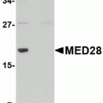 Western blot analysis of MED28 in human brain tissue lysate with MED28 antibody at 1 μg/mL in (A) the absence and (B) the presence of blocking peptide.