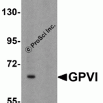 Western blot analysis of GPVI in A20 lysate with GPVI antibody at 1μg/mL in either the absence or (B) the presence of blocking peptide.