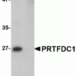 Western blot analysis of PRTFDC1 in human brain tissue lysate with PRTFDC1 antibody at 1 μg/mL in the (A) absence and (B) presence of blocking peptide.