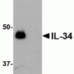 Western blot analysis of IL-34 in human brain tissue lysate with IL-34 antibody at 0.25 μg/mL in (A) the absence and (B) the presence of blocking peptide.