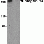Western blot analysis of Integrin alpha 4 in Jurkat cell lysate with Integrin alpha 4 antibody at 1 μg/mL in (A) the absence and (B) the presence of blocking peptide.