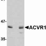 Western blot analysis of ACVR1 in A549 cell lysate with ACVR1 antibody at 1 μg/mL in (A) the absence and (B) the presence of blocking peptide.