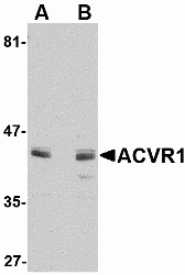 ACVR1 Peptide