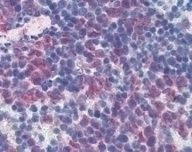 CD69 Antibody [H1.2F3] (FITC)