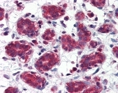 PSMA Antibody [K1H7]