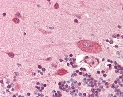 Podoplanin Antibody [5E2]