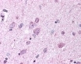 PAEL Receptor Antibody