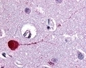 CHRM3 Antibody