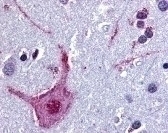 CHRM3 Antibody