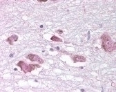 MCHR1 Antibody