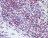 XCR1 Antibody