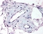 ADAMTS1 Antibody