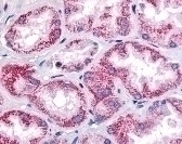 OXGR1 Antibody