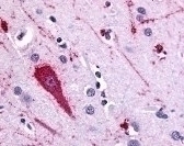 HTR5A Antibody