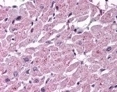 CYSLTR2 Antibody