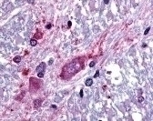 SLC5A3 Antibody
