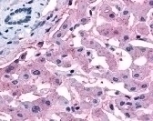SLC5A4 Antibody