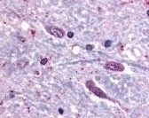 SLC5A3 Antibody