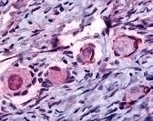 NR4A1 Antibody