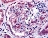 EPHA4 Antibody