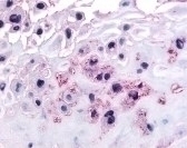 DDR1 Antibody