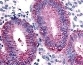 DKK1 Antibody