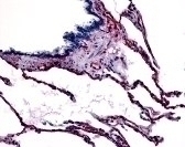 Caveolin-1 Antibody