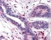 PTK2 Antibody