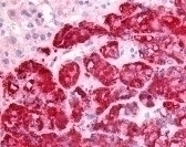 SPHK1 Antibody