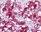 VIPR1 Antibody