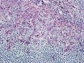 CCR8 Antibody
