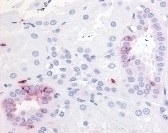 PTGER2 Antibody