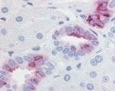PTGER2 Antibody