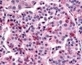 Frizzled 5 Antibody