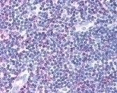CCR4 Antibody