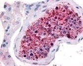 Frizzled 9 Antibody
