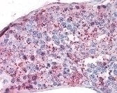 Steroidogenic Factor 1 Antibody