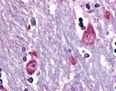 CHRM3 Antibody
