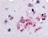 BAI1 Antibody