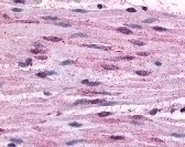 ADRA1B Antibody