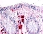 MST1R Antibody