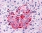 SGK3 Antibody