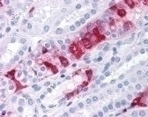 SGK3 Antibody