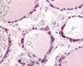 PDE1C Antibody