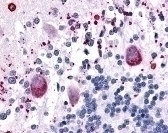 HTR7 Antibody